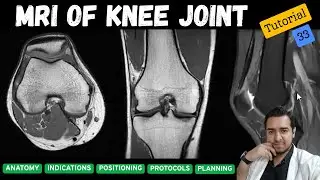 MRI of Knee Joint-Part-01 | MRI Technique Course-Tutorial-33 | Anatomy | Indications | Protocols |