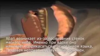 Антихрап доктор храп экс спрей - смотрите!