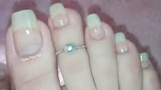 What to do When Your Toe Nails Start Bending When They Grow? DIY Tips | Rose Pearl