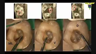 D4S1C1 