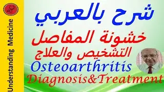 OA_ Diagnosis and Treatment  شرح بالعربي : تشخيص وعلاج خشونة المفاصل