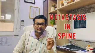 3 signs of low back pain you should not ignore !!