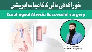 Esophageal Atresia Successful Surgery in Newborn | Father&rsquo;s Review | KidsCare International Hospital