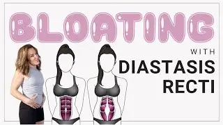 Does Diastasis Recti Cause Bloating? Explained!