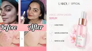 laikou japan sakura serum review |My skin transformation Journey|