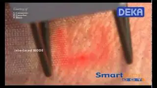 SmartXide DOT