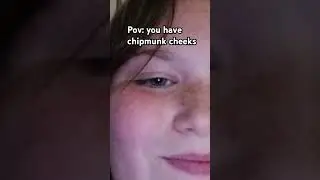 Pov: you have chipmunk cheeks