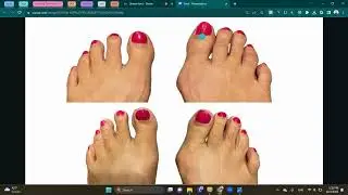 SC Toes 2