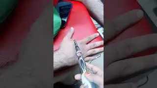 Magical treatment for pain | Ortho Neuro Care Center | Dr Sumaiya R Khan