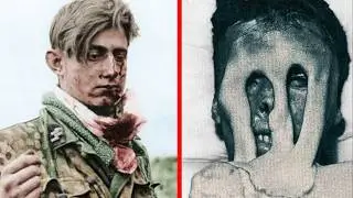 The HORRORS of Chemical Weapons in WW2 *WARNING Disturbing Historical Content