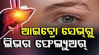 Eyebrow Threading Could Cause Liver Failure, Doctor Shares Reel Of Hepatitis Scare From Parlour