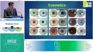 Eye Color Change - Eyecos Meeting 2021