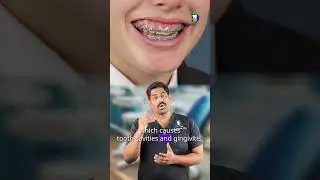 Can braces cause swollen gums? - Braces gingivitis | Dr.karthikeyan | Denta Kings