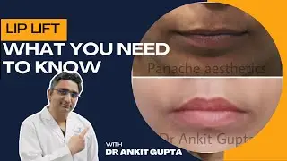 Lip Lift Surgery &ndash; What to Expect Before, During & After | Upper Lip Shortening Procedure Explained