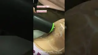 LASER HAIR REDUCTION | DR. ANKUR SARIN | SARIN SKIN SOLUTION |