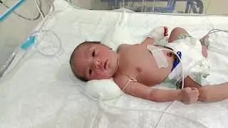 6 babies are admitted to the ICU #nicu #babycare 