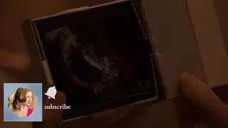 Daniel Victoria Grayson and Emily´s pregnancy lie