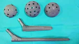 Implants for Revision Hip Replacement