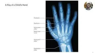 Lecture 6c   Bone Tissue - Bone Development