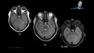 How to Read Normal Head MRI