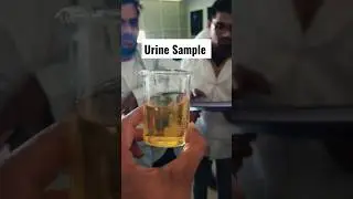 Urine Test...😊😊#shorts #ytshorts #laboratory