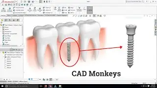 Modelling of Dental Implant Screw using Solidworks