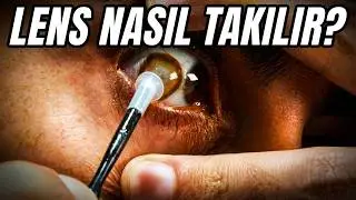 Lens Nasıl Takılır? 20 Dakikalık En Kapsamlı Rehber (Bilmen Gereken Her Şey)