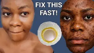 No one told me this - but it changed my skin overnight