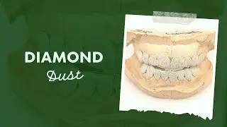 Unlock Your Inner Star: The Power of Diamond Dust Grillz