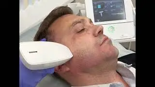 Микроигольчатый фракционный RF термолиз Venus Viva