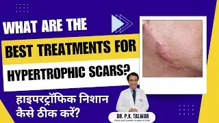 Best Treatment for Hypertrophic Scars on Face | Scar Treatment Clinic In Delhi | Dr. PK Talwar