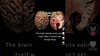 Your Brain Will Eat Itself If You Do This 😰 #disturbing