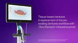 How to scan dentures with the iTero Element&trade; Plus scanner | tissue-based workflow for replacements