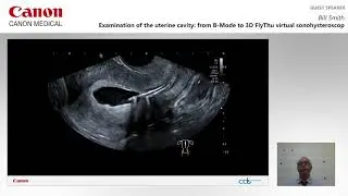 ISUOG 2020 Bill Smith-Exam of the uterine cavity: B-mode to 3D FlyThru virtual sonohysteroscopy