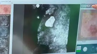 Confocal Microscopy Demonstration