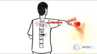Chiropractors North Las Vegas | Disc Pain | Active Life Health and Wellness (702)-636-2843