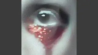 You Shed Your Skin