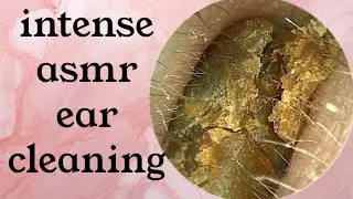 intense asmr ear cleaning