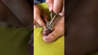 Easy way to remove a ring stuck on your finger