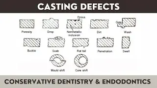 Prevention of Dental Casting Defects | Suck Back Porosity | Types