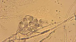 Releasing Oospores from Oogonium (Oomycetes)