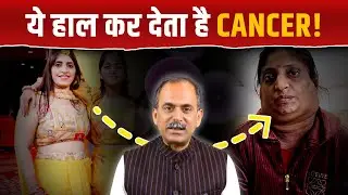 Last Stage Cancer Treatment without Surgery | 19 दिनों में मिला  Cancer में आराम | Acharya Manish ji