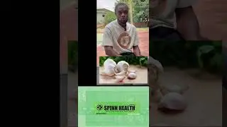 Drink This Onion Tea Daily for a Healthier Heart | Natural Remedy for Blocked Arteries & Palpitation