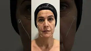 Face Surgery: Restore, Refine, and Reveal Your Confidence