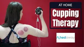 Self Cupping Therapy