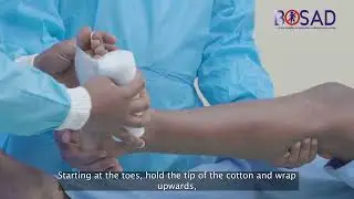 7  Short Leg Cast Application