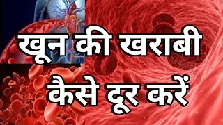 खून की खराबी के लिए क्या करें Blood Purifier Best Syrup Uses
