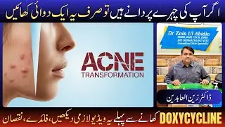 My Top 5 Doxycycline WARNINGS for Acne Treatment You Should Know