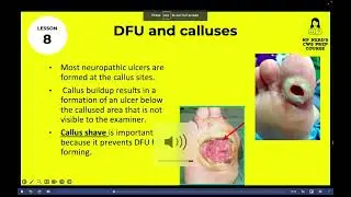 Certified Wound Specialist (CWS) Prep Course
