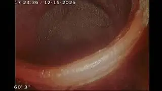 2025 12 15 17 15 51